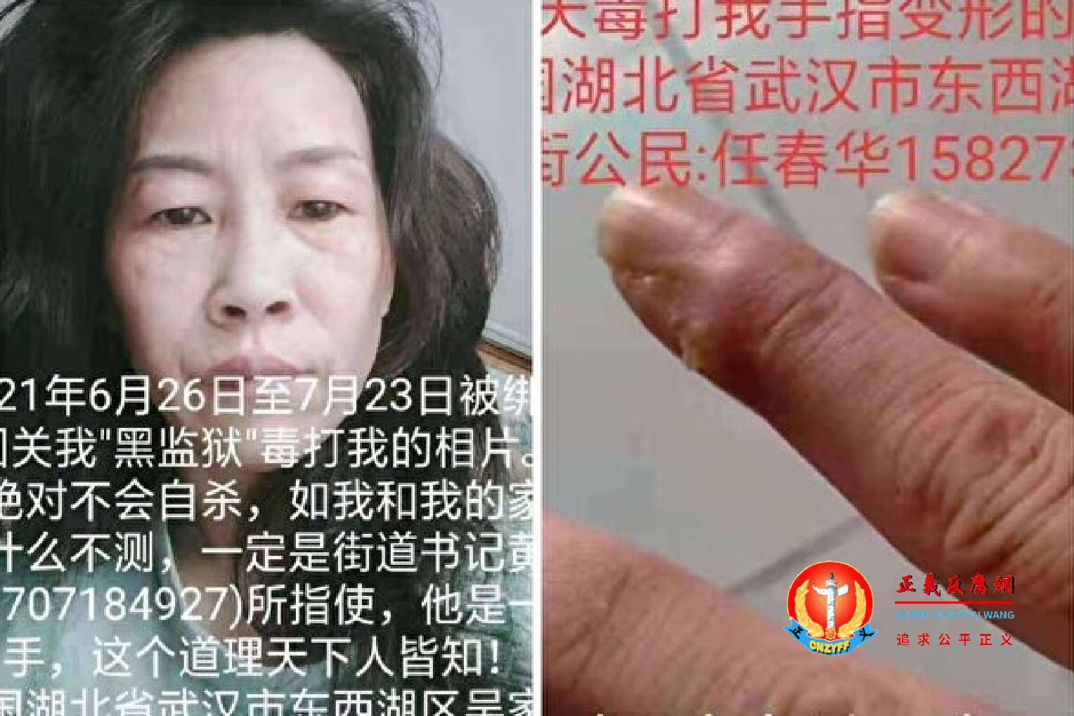 湖北武汉女访民被关入黑监狱28天，遭黑保安脱服羞辱电击、拍裸照