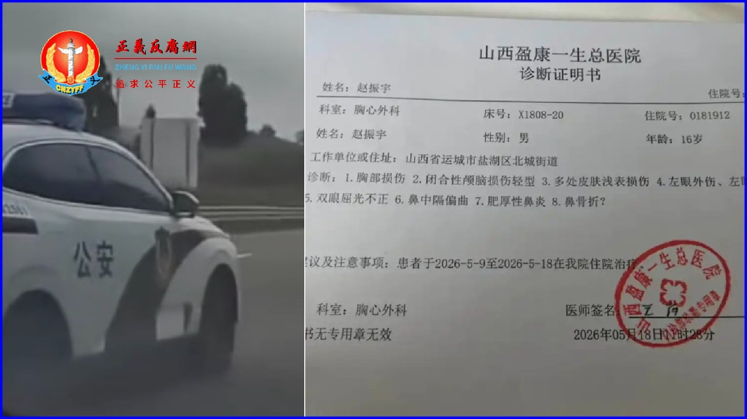 山西一16岁男生被同校校友在家门口殴打致伤,报警后,肇事者邀假警察将受害人骗出再次进行殴打。赵先生提供儿子被殴打受伤一份2026年5月8日,山西盈康一生总医院出具的诊断证明书。.jpg 山西一16岁男生被同校校友在家门口殴打致伤,报警后,肇事者邀假警察将受害人骗出再次进行殴打。赵先生提供儿子被殴打受伤一份2026年5月8日,山西盈康一生总医院出具的诊断证明书。.jpg